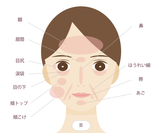 主なヒアルロン酸注入部位