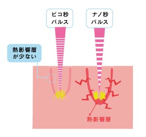 ピコ秒パルス